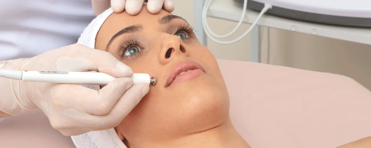 procedimento de estética facial com tecnologia avançada em Campinas