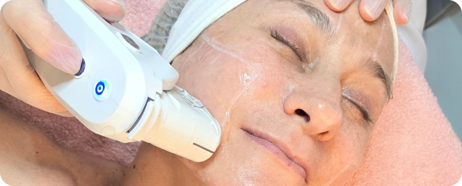 Tecnologias avançadas para tratamento de Flacidez Facial em Campinas SP