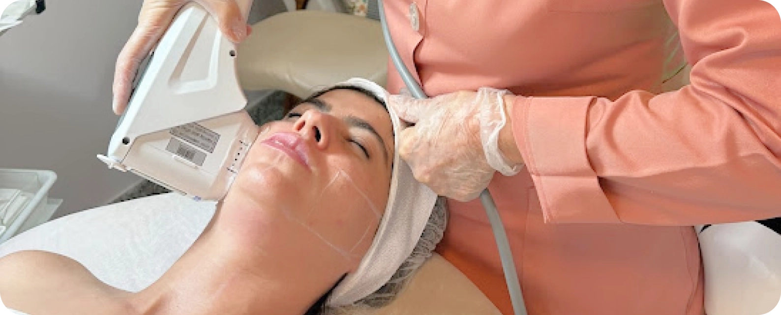 Profissional realizando tratamento de ultrassom microfocado para flacidez facial e estímulo de colágeno em Campinas.