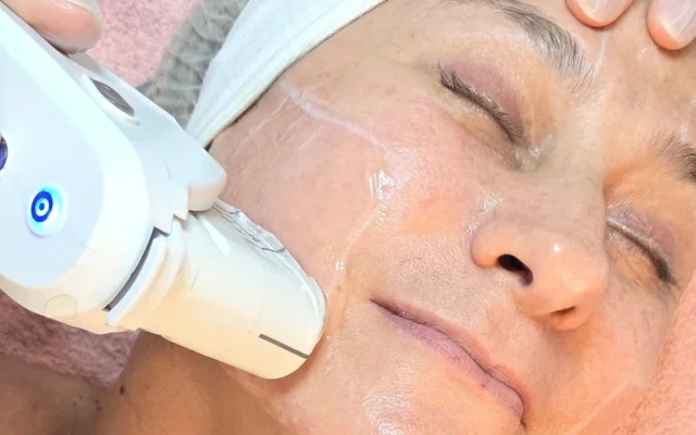 Tecnologias avançadas para tratamento de Flacidez Facial em Campinas SP