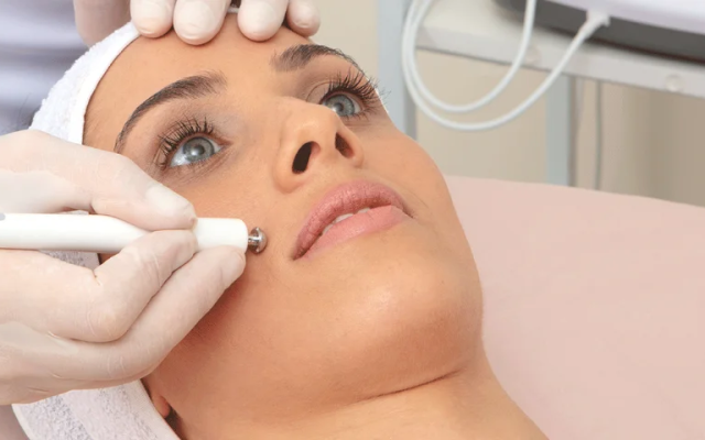 procedimento de estética facial com tecnologia avançada em Campinas